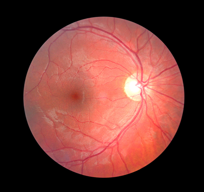 retina